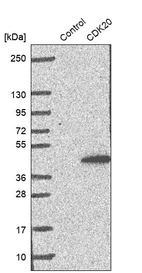 Western blot analysis in control (vector only transfected HEK293T lysate) and CDK20 over-expression lysate (Co-expressed with a C-terminal myc-DDK tag (~3.1 kDa) in mammalian HEK293T cells, LY421833).