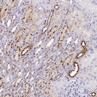 Anti-MMACHC Antibody