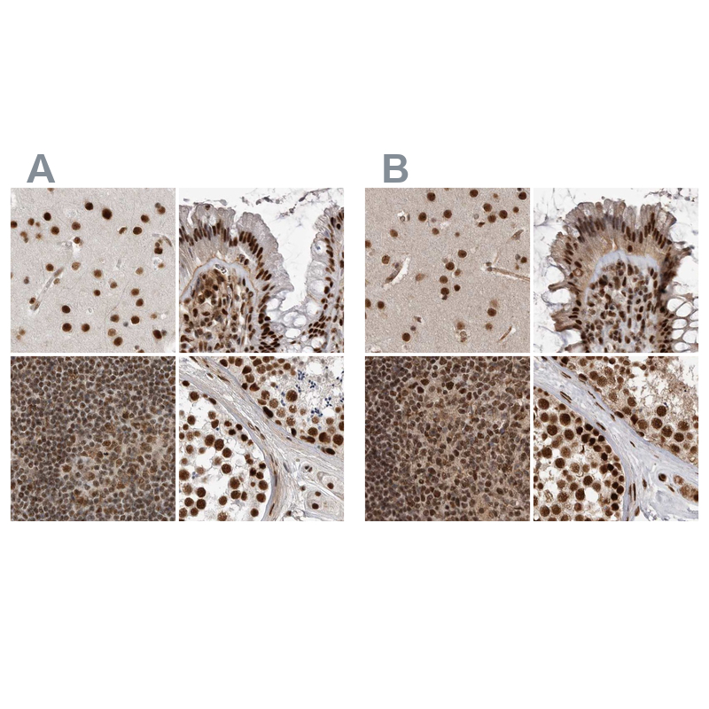 Anti-PPP1R8 Antibody