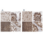 Anti-PPP1R8 Antibody