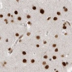 Immunohistochemical staining of human cerebral cortex shows strong nuclear positivity in neuronal cells.