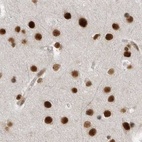 Anti-PPP1R8 Antibody