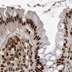 Immunohistochemical staining of human colon shows strong nuclear positivity in glandular cells.