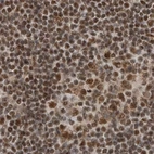 Immunohistochemical staining of human lymph node shows strong nuclear positivity in non-germinal center cells.