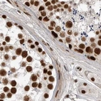 Immunohistochemical staining of human testis shows strong nuclear positivity in cells in seminiferous ducts.