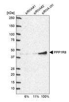 Anti-PPP1R8 Antibody