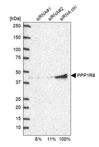 Western blot analysis in U2OS cells transfected with control siRNA, target specific siRNA probe #1 and #2, using Anti-PPP1R8 antibody. Remaining relative intensity is presented.