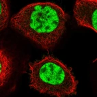 Immunofluorescent staining of human cell line A-431 shows localization to nuclear speckles.