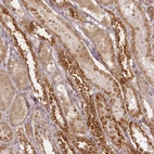 Immunohistochemical staining of human kidney shows strong cytoplasmic positivity in cells in tubules.