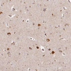 Immunohistochemical staining of human cerebral cortex shows strong cytoplasmic positivity in neurons.