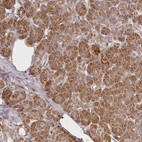 Immunohistochemical staining of human pancreas shows moderate cytoplasmic positivity in exocrine glandular cells.