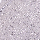 Immunohistochemical staining of human smooth muscle shows no positivity in smooth muscle cells.