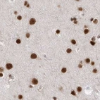 Immunohistochemical staining of human cerebral cortex using Anti-PPP1R8 antibody HPA027417.