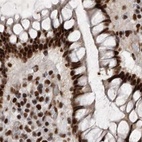 Immunohistochemical staining of human colon using Anti-PPP1R8 antibody HPA027417.