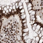 Immunohistochemical staining of human colon using Anti-PPP1R8 antibody HPA027417.