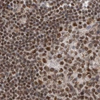 Immunohistochemical staining of human lymph node using Anti-PPP1R8 antibody HPA027417.