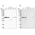 Western blot analysis using Anti-PPP1R8 antibody HPA027417 (A) shows similar pattern to independent antibody HPA027406 (B).