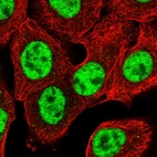 Immunofluorescent staining of human cell line A-431 shows localization to nuclear speckles.
