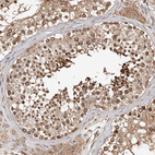 Immunohistochemical staining of human testis shows strong cytoplasmic positivity in cells in seminiferous ducts.