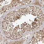 Immunohistochemical staining of human testis shows strong cytoplasmic positivity in cells in seminiferous ducts.