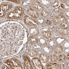 Immunohistochemical staining of human kidney shows moderate cytoplasmic positivity in cells in tubules.