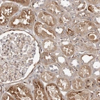 Immunohistochemical staining of human kidney shows moderate cytoplasmic positivity in cells in tubules.