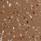 Immunohistochemical staining of human cerebral cortex shows strong cytoplasmic positivity in neurons.