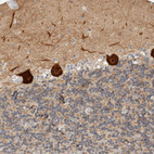 Immunohistochemical staining of human cerebellum shows strong cytoplasmic positivity in Purkinje cells.