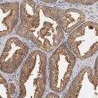 Immunohistochemical staining of human prostate shows moderate cytoplasmic and membranous positivity in glandular cells.