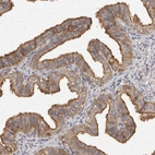Immunohistochemical staining of human fallopian tube shows moderate cytoplasmic positivity in glandular cells.
