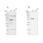 Western blot analysis using Anti-BAIAP2 antibody HPA027421 (A) shows similar pattern to independent antibody HPA023310 (B).