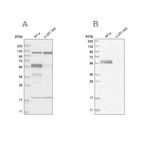 Western blot analysis using Anti-BAIAP2 antibody HPA027421 (A) shows similar pattern to independent antibody HPA023310 (B).