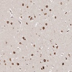 Anti-GSG2 Antibody