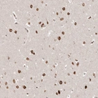 Anti-GSG2 Antibody