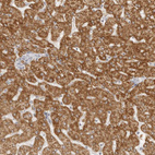 Anti-HMGCS2 Antibody