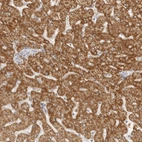 Immunohistochemical staining of human liver shows strong granular cytoplasmic positivity in hepatocytes.