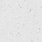 Immunohistochemical staining of human cerebral cortex shows no positivity in neurons as expected.