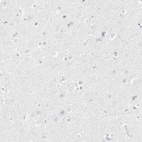 Anti-HMGCS2 Antibody