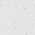 Immunohistochemical staining of human cerebral cortex shows no positivity in neurons as expected.