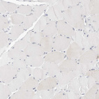 Immunohistochemical staining of human skeletal muscle shows no positivity in myocytes as expected.