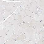 Immunohistochemical staining of human skeletal muscle shows no positivity in myocytes as expected.