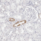 Anti-HMGCS2 Antibody