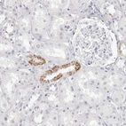 Immunohistochemical staining of human kidney shows moderate granular cytoplasmic positivity in cells in tubules.