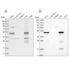 Western blot analysis using Anti-HMGCS2 antibody HPA027423 (A) shows similar pattern to independent antibody HPA027442 (B).