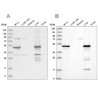 Western blot analysis using Anti-HMGCS2 antibody HPA027423 (A) shows similar pattern to independent antibody HPA027442 (B).