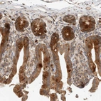 Anti-PUM1 Antibody