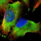 Immunofluorescent staining of human cell line U-251 MG shows positivity in cytoplasm.
