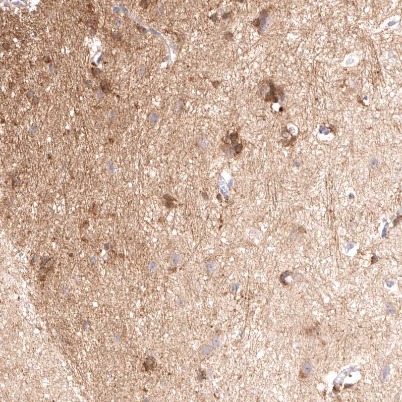 Anti-VPS45 Antibody