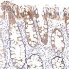 Immunohistochemical staining of human colon shows moderate granular cytoplasmic positivity in glandular cells.
