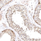 Immunohistochemical staining of human testis shows moderate granular cytoplasmic positivity in cells in seminiferous ducts.